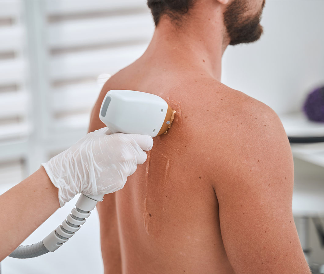 A professional laser hair removal treatment at a Virginia Beach med spa A professional laser hair removal treatment at a Virginia Beach med spa