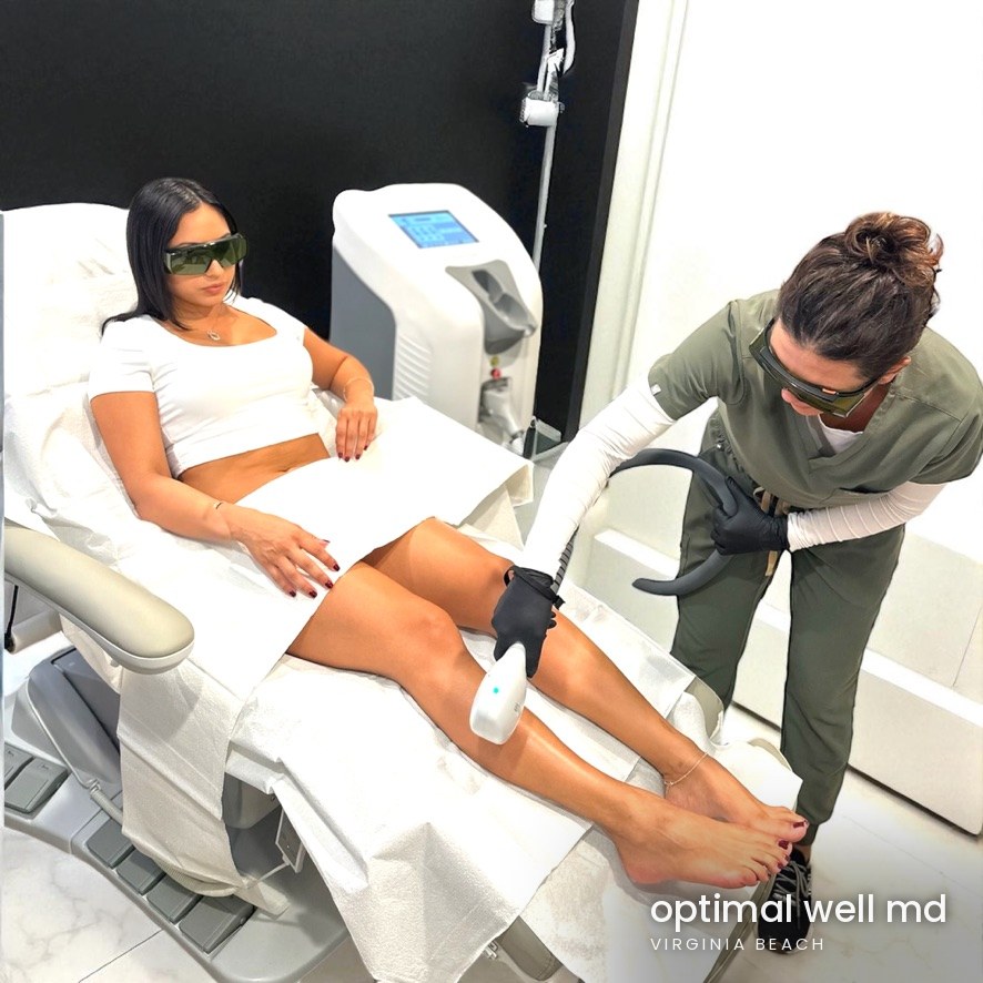 A provider in protective eyewear performs a laser hair removal treatment on a patient’s lower leg in a treatment room at Optimal Well MD in Virginia Beach