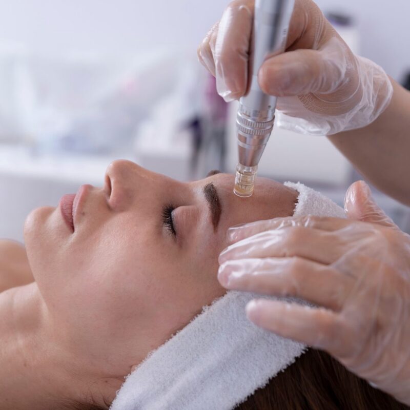 Mesotherapy for Skin Rejuvenation: What to Expect